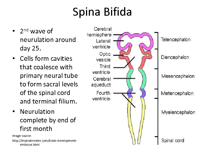 Spina Bifida • 2 nd wave of neurulation around day 25. • Cells form