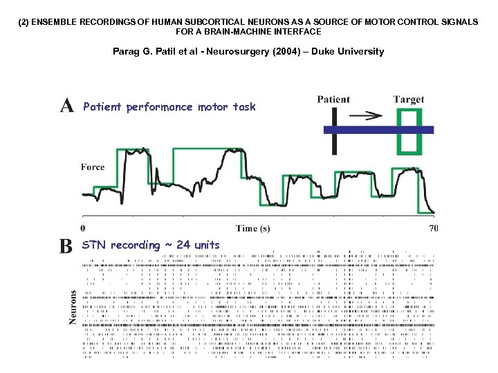 (2) ENSEMBLE RECORDINGS OF HUMAN SUBCORTICAL NEURONS AS A SOURCE OF MOTOR CONTROL SIGNALS