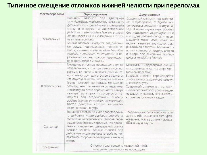 Типичное смещение отломков нижней челюсти при переломах 