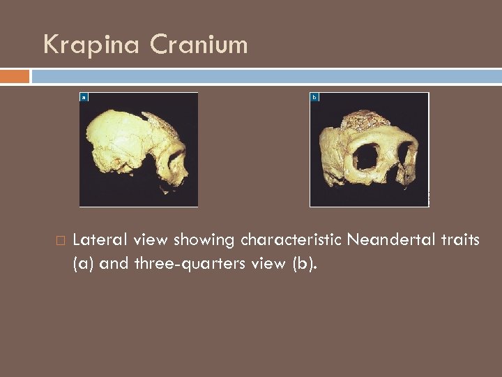 Krapina Cranium Lateral view showing characteristic Neandertal traits (a) and three-quarters view (b). 