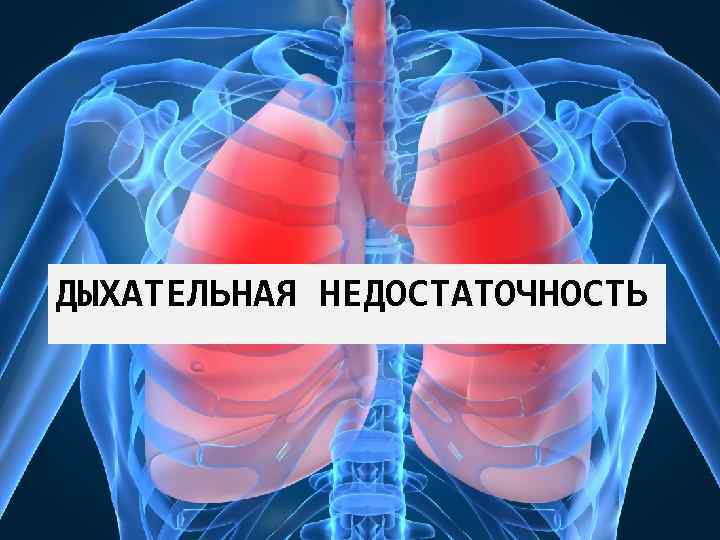 Острая дыхательная недостаточность презентация