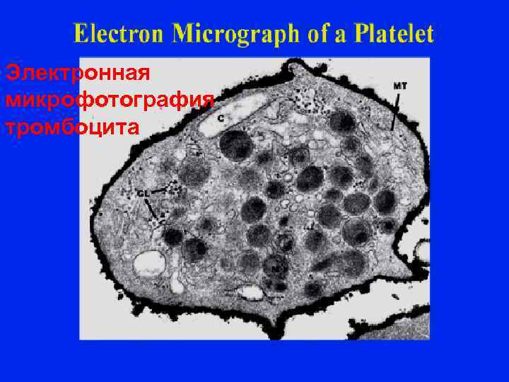 Электронная микрофотография тромбоцита 