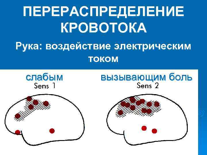 ПЕРЕРАСПРЕДЕЛЕНИЕ КРОВОТОКА Рука: воздействие электрическим током слабым вызывающим боль 