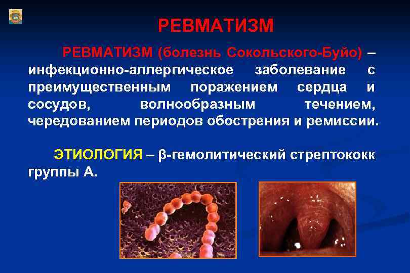 РЕВМАТИЗМ (болезнь Сокольского-Буйо) – инфекционно-аллергическое заболевание с преимущественным поражением сердца и сосудов, волнообразным течением,