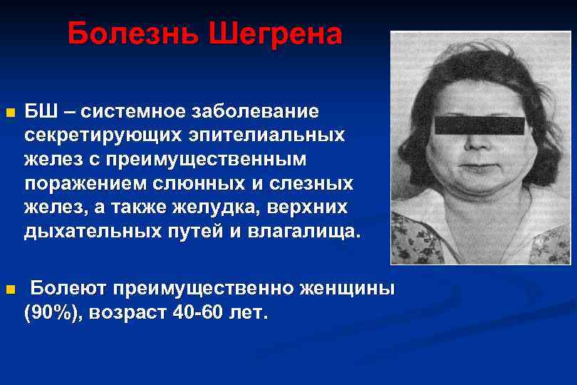 Болезнь шегрена. Системное заболевание Шегрена. Глаза у больных синдромом Шегрена.