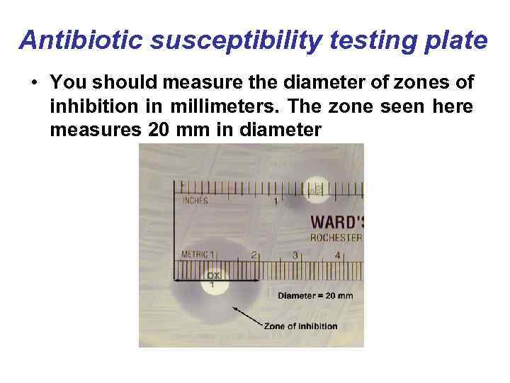 Antibiotic susceptibility testing plate • You should measure the diameter of zones of inhibition