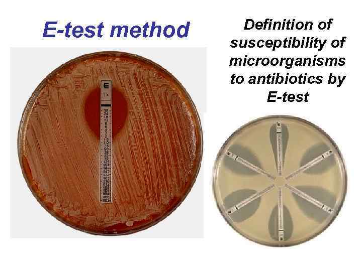 E-test method Definition of susceptibility of microorganisms to antibiotics by E-test 