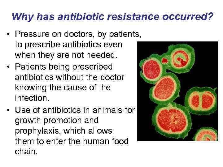 Why has antibiotic resistance occurred? • Pressure on doctors, by patients, to prescribe antibiotics