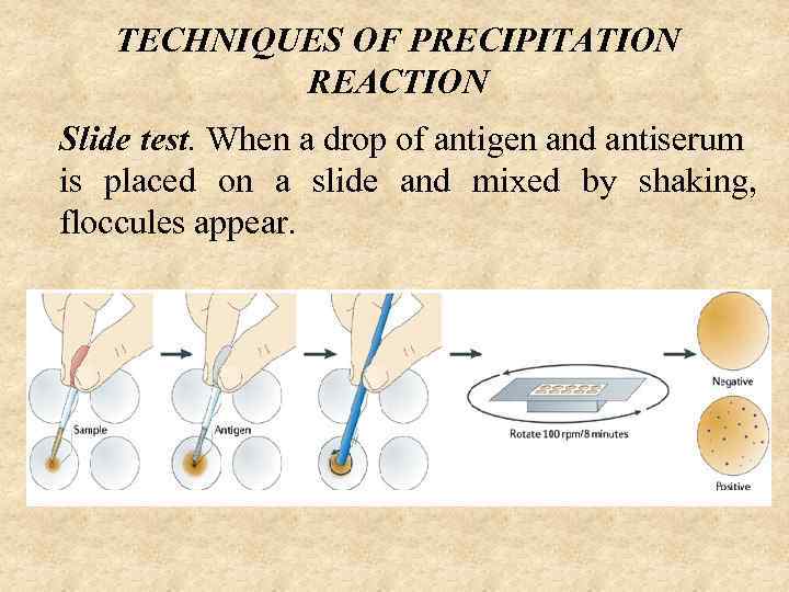 TECHNIQUES OF PRECIPITATION REACTION Slide test. When a drop of antigen and antiserum is