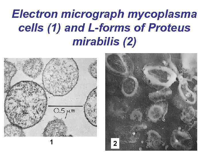 Electron micrograph mycoplasma cells (1) and L-forms of Proteus mirabilis (2) 1 2 