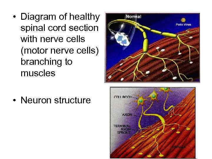  • Diagram of healthy . spinal cord section with nerve cells (motor nerve