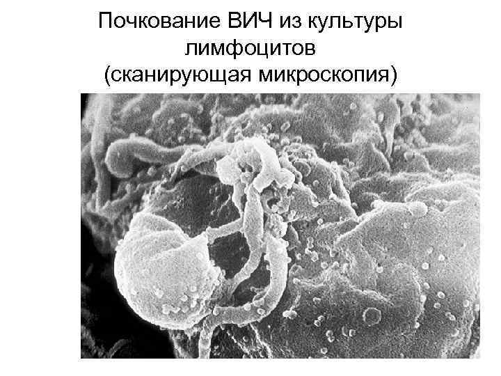 Почкование ВИЧ из культуры лимфоцитов (сканирующая микроскопия) 