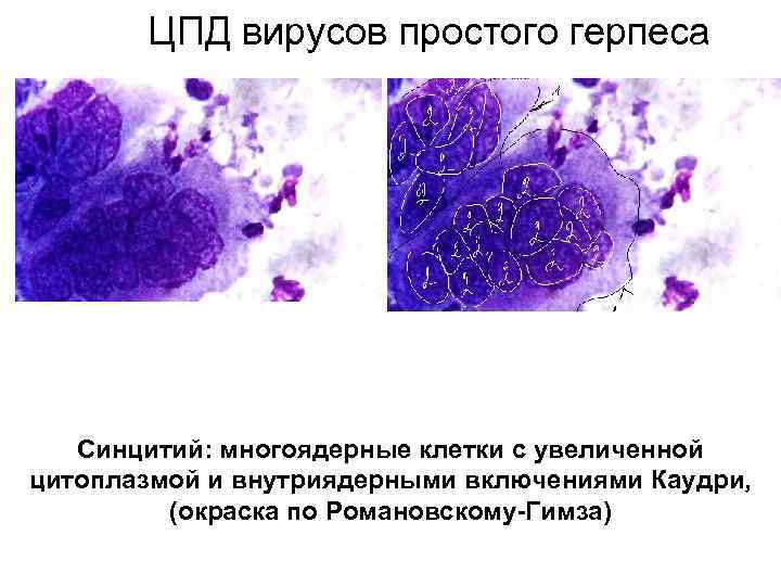 Онкогенные вирусы микробиология презентация