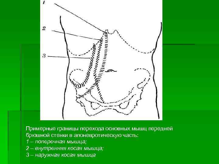 Нарисовать топографические области передней брюшной стенки