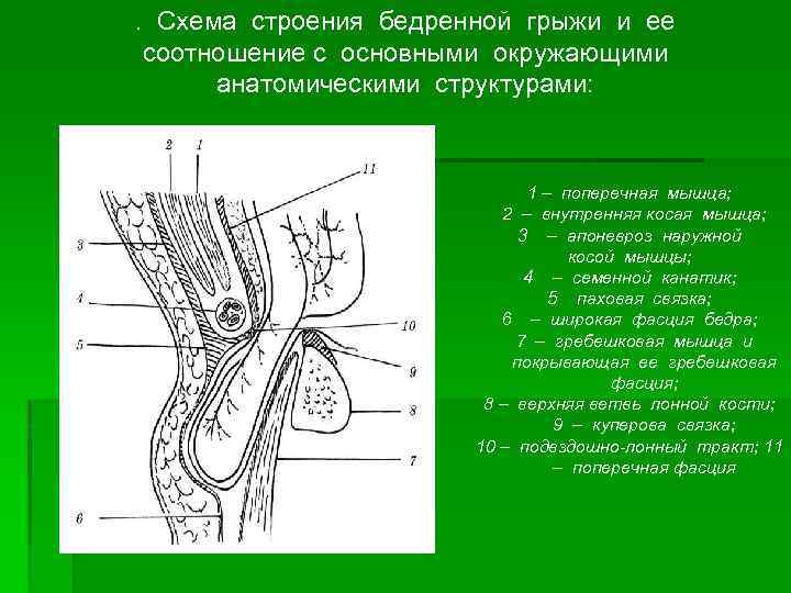 Бедренные грыжи топографическая анатомия презентация