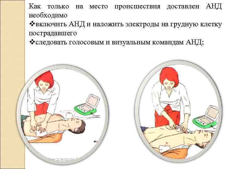 Как только на место происшествия доставлен АНД необходимо vвключить АНД и наложить электроды на