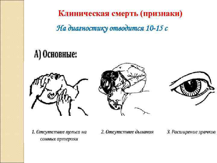 Клиническая смерть (признаки) На диагностику отводится 10 -15 с 