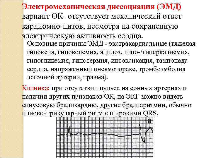 Электромеханическая диссоциация (ЭМД) вариант ОК- отсутствует механический ответ кардиомио-цитов, несмотря на сохраненную электрическую активность