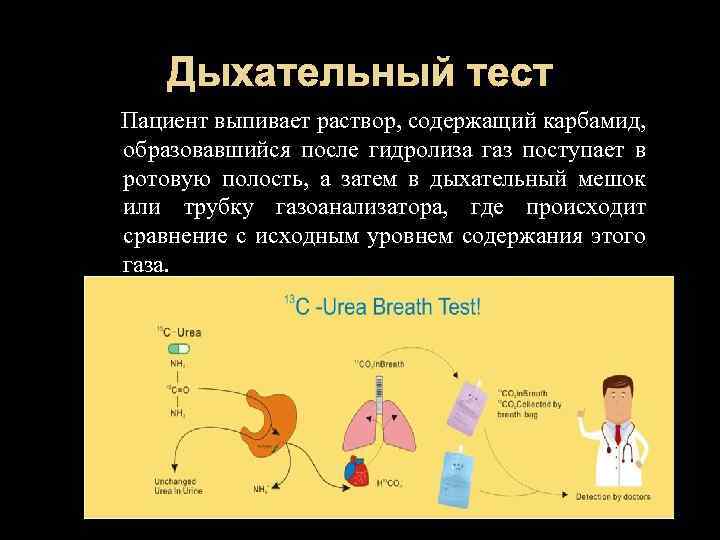 Дыхательный тест Пациент выпивает раствор, содержащий карбамид, образовавшийся после гидролиза газ поступает в ротовую