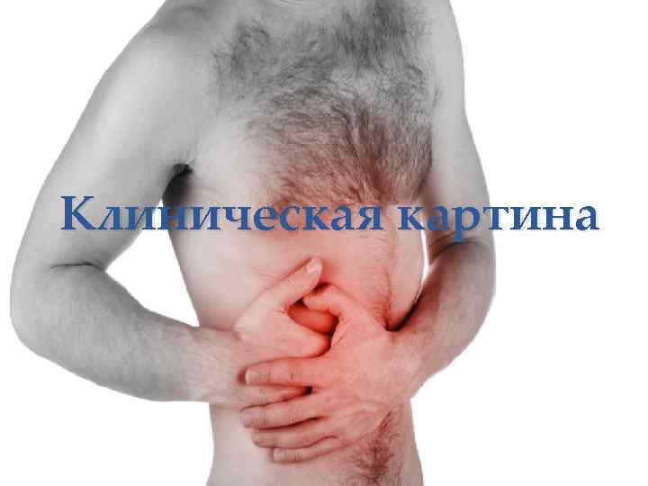 Клиническая картина 