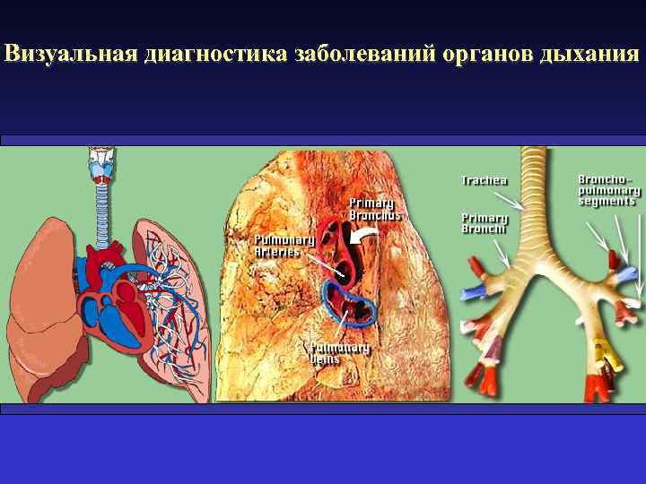 Визуальная диагностика заболеваний органов дыхания 