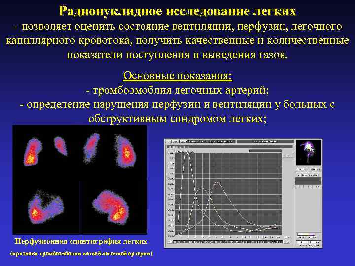 Радионуклидное исследование легких – позволяет оценить состояние вентиляции, перфузии, легочного капиллярного кровотока, получить качественные