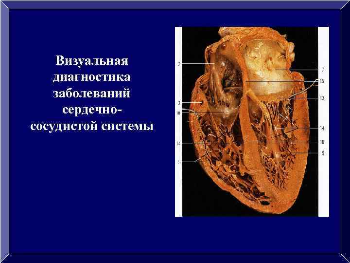 Визуальная диагностика заболеваний сердечнососудистой системы 