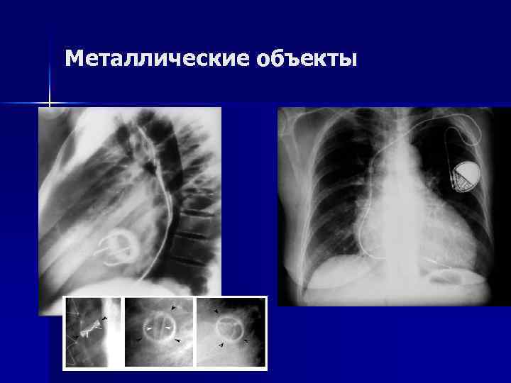 Металлические объекты 