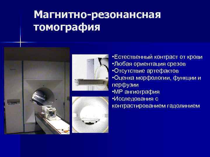 Магнитно-резонансная томография • Естественный контраст от крови • Любая ориентация срезов • Отсутствие артефактов