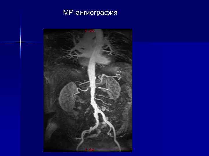 МР-ангиография 