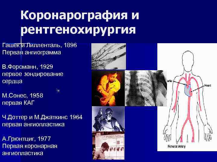 Коронарография и рентгенохирургия Гашек и Лилленталь, 1896 Первая ангиограмма В. Форсманн, 1929 первое зондирование