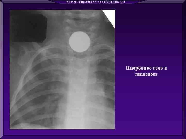 Р Е Н Т Г Е Н О Д И А Г Н О