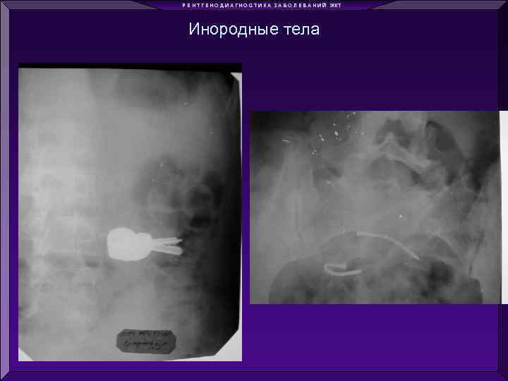 Р Е Н Т Г Е Н О Д И А Г Н О