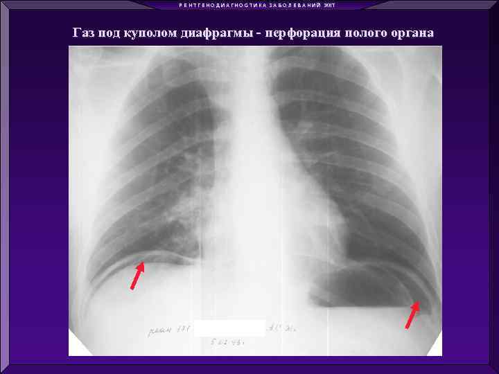 Р Е Н Т Г Е Н О Д И А Г Н О