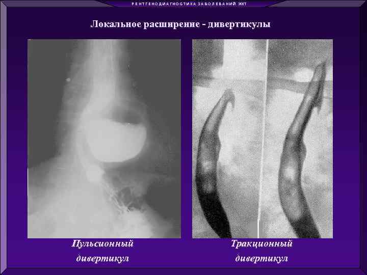 Р Е Н Т Г Е Н О Д И А Г Н О