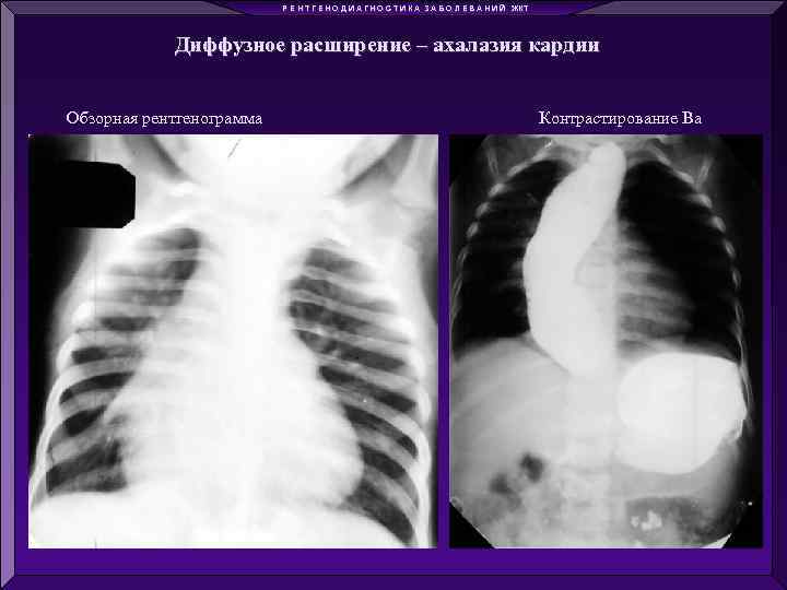 Р Е Н Т Г Е Н О Д И А Г Н О