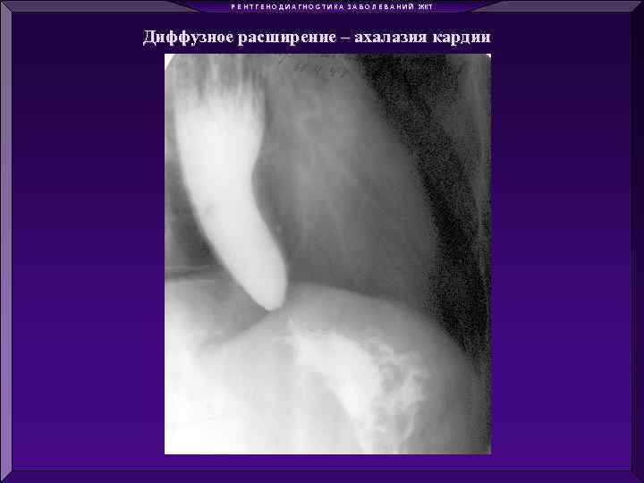 Р Е Н Т Г Е Н О Д И А Г Н О