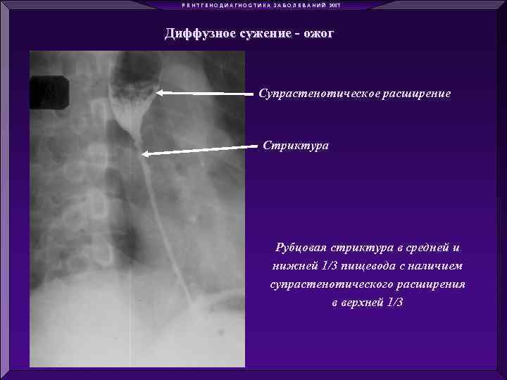 Р Е Н Т Г Е Н О Д И А Г Н О