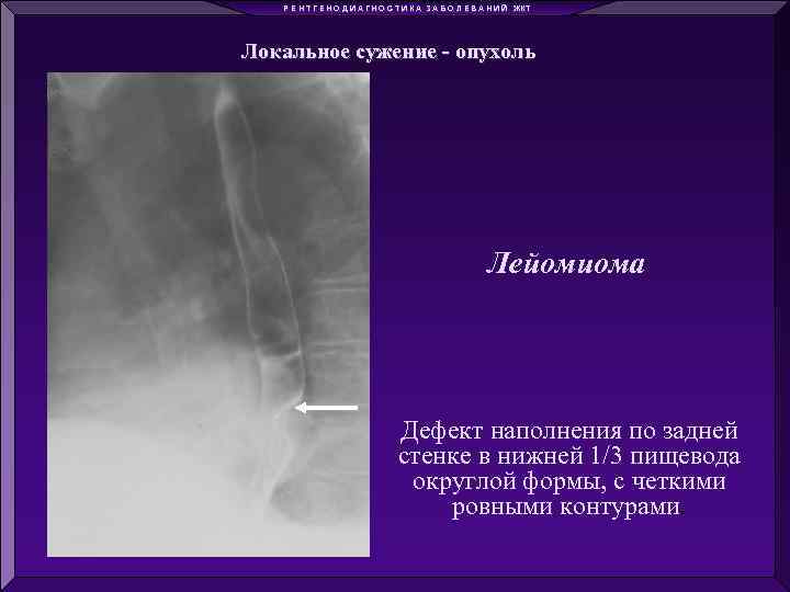 Р Е Н Т Г Е Н О Д И А Г Н О