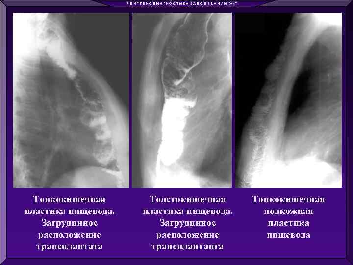 Р Е Н Т Г Е Н О Д И А Г Н О