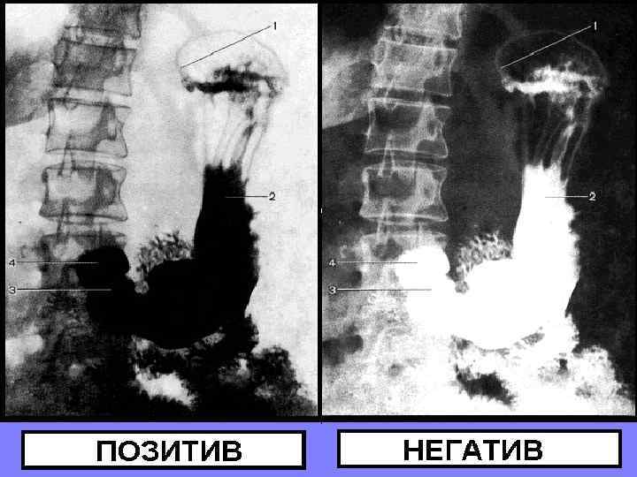 Р Е Н Т Г Е Н О Д И А Г Н О