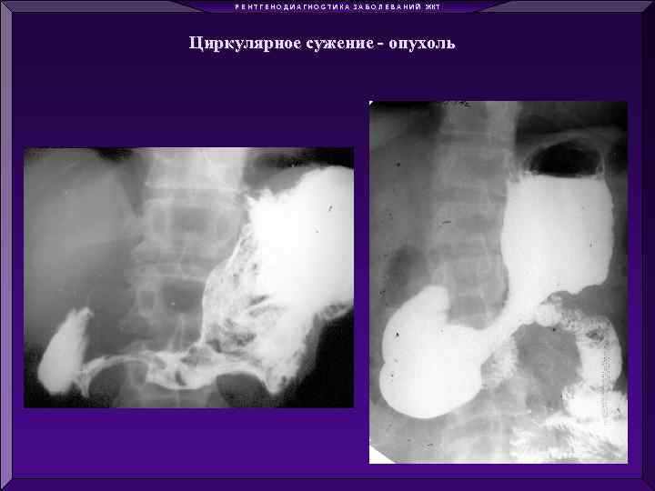 Р Е Н Т Г Е Н О Д И А Г Н О