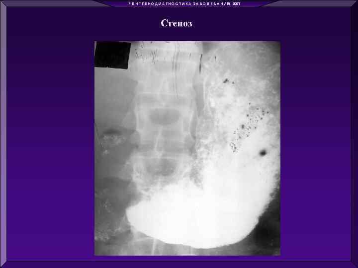 Р Е Н Т Г Е Н О Д И А Г Н О