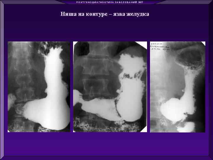 Р Е Н Т Г Е Н О Д И А Г Н О