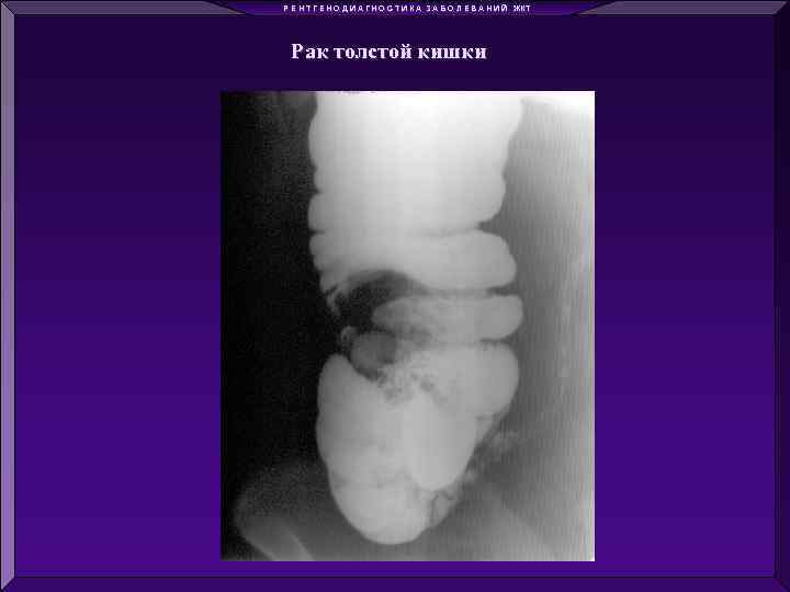 Р Е Н Т Г Е Н О Д И А Г Н О