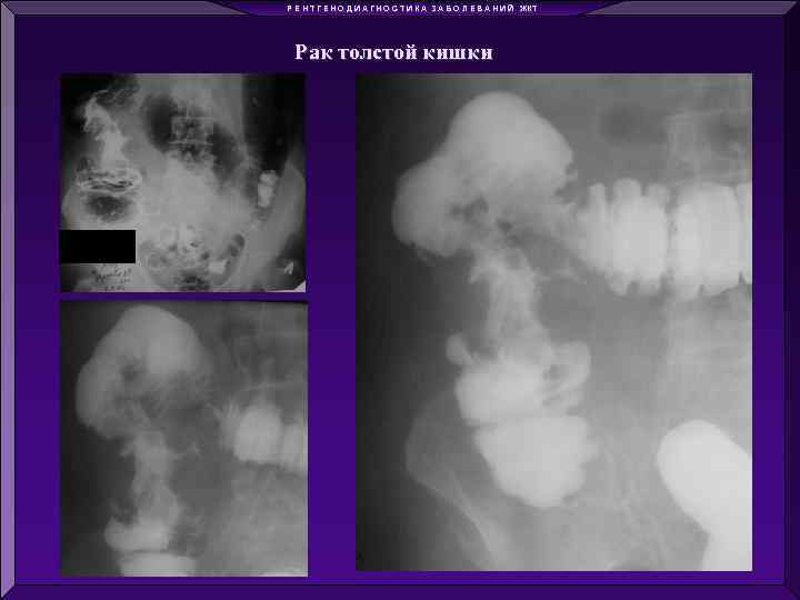 Р Е Н Т Г Е Н О Д И А Г Н О