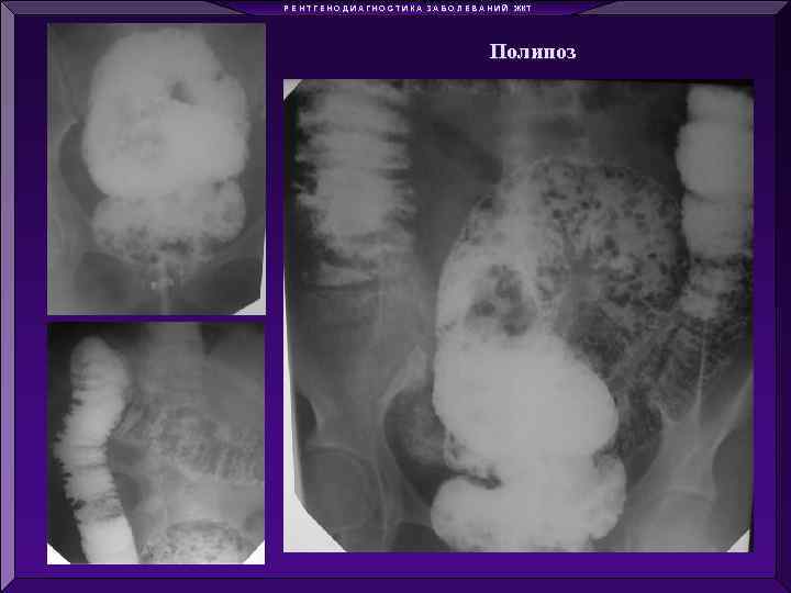 Р Е Н Т Г Е Н О Д И А Г Н О