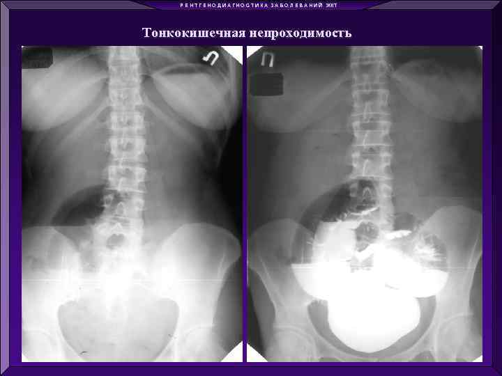 Р Е Н Т Г Е Н О Д И А Г Н О