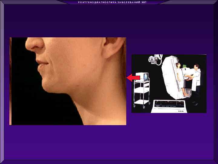 Р Е Н Т Г Е Н О Д И А Г Н О