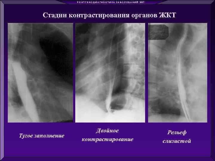 Р Е Н Т Г Е Н О Д И А Г Н О